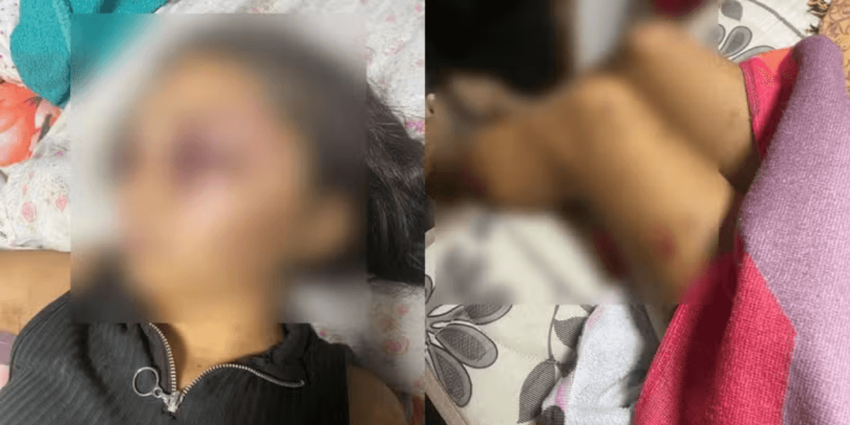 Adolescente é mantida em cativeiro e brutalmente agredida pelo namorado no Ceará • Foto: Redes Sociais