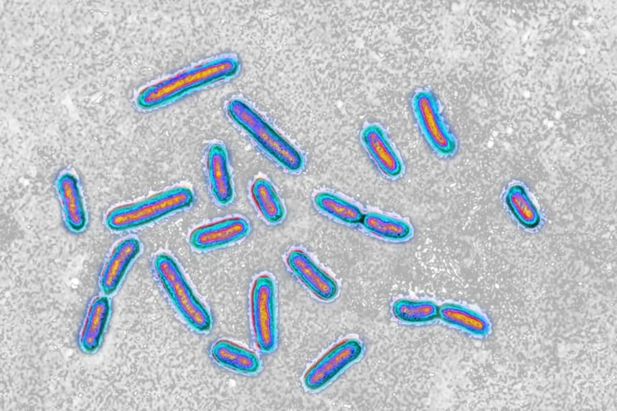Pseudomonas aeruginosa: bactéria em formato de bacilo causa infecções em diversos tecidos e é comum em hospitais