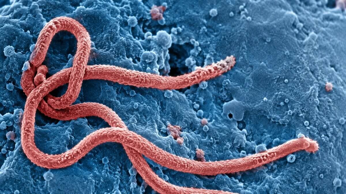 Ebola, imagem gerada por IA