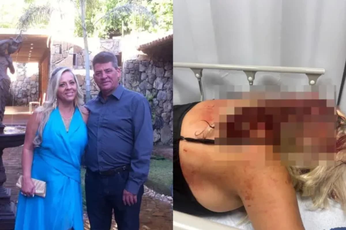 Polícia pede medida protetiva para mulher agredida com barra de ferro pelo marido em BH • Imagens cedidas / Itatiaia