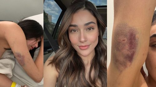 Empresária-de-BH-diz-que-foi-espancada-por-ex-companheiro-na-noite-de-Ano-Novo