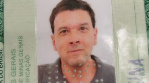 Homem-morre-durante-tratamento-de-canal-em-clínica-odontológica-de-Contagem