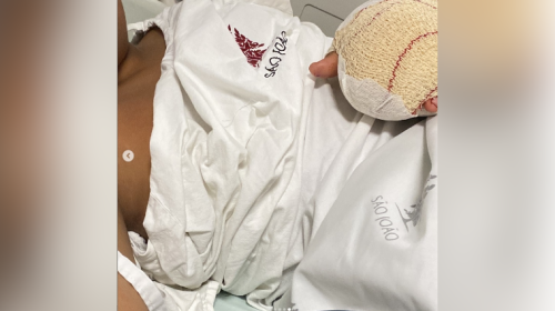 Mãe denuncia agressão a menino brasileiro em escola de Portugal