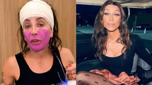 Maya Massafera faz cirurgia para deixar o rosto mais delicado