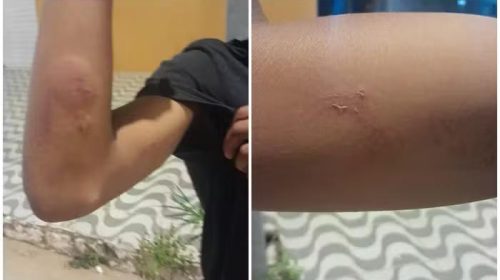 Foto: Reprodução