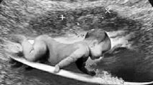 Foto: Gabriel Medina/ Instagram