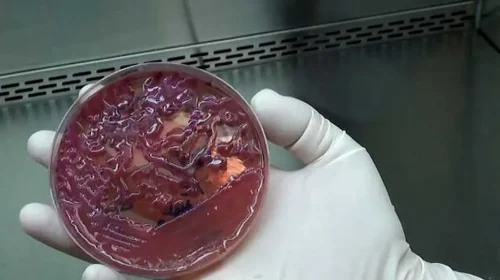 superbactéria KPC (Klebsiella Pneumoniae Carbapenemase)